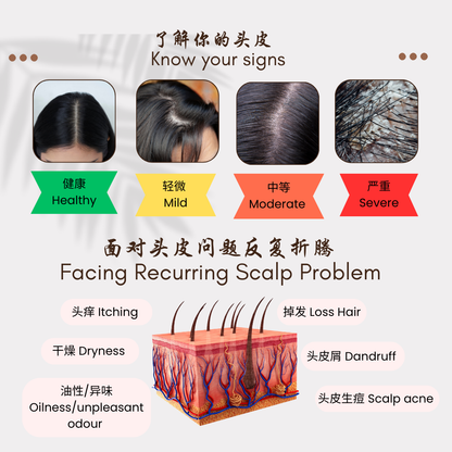 Scalp Revitalizing Essence 100ml