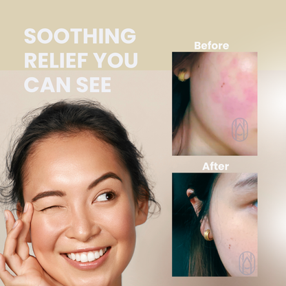 3 in 1 Basic Skin Care set