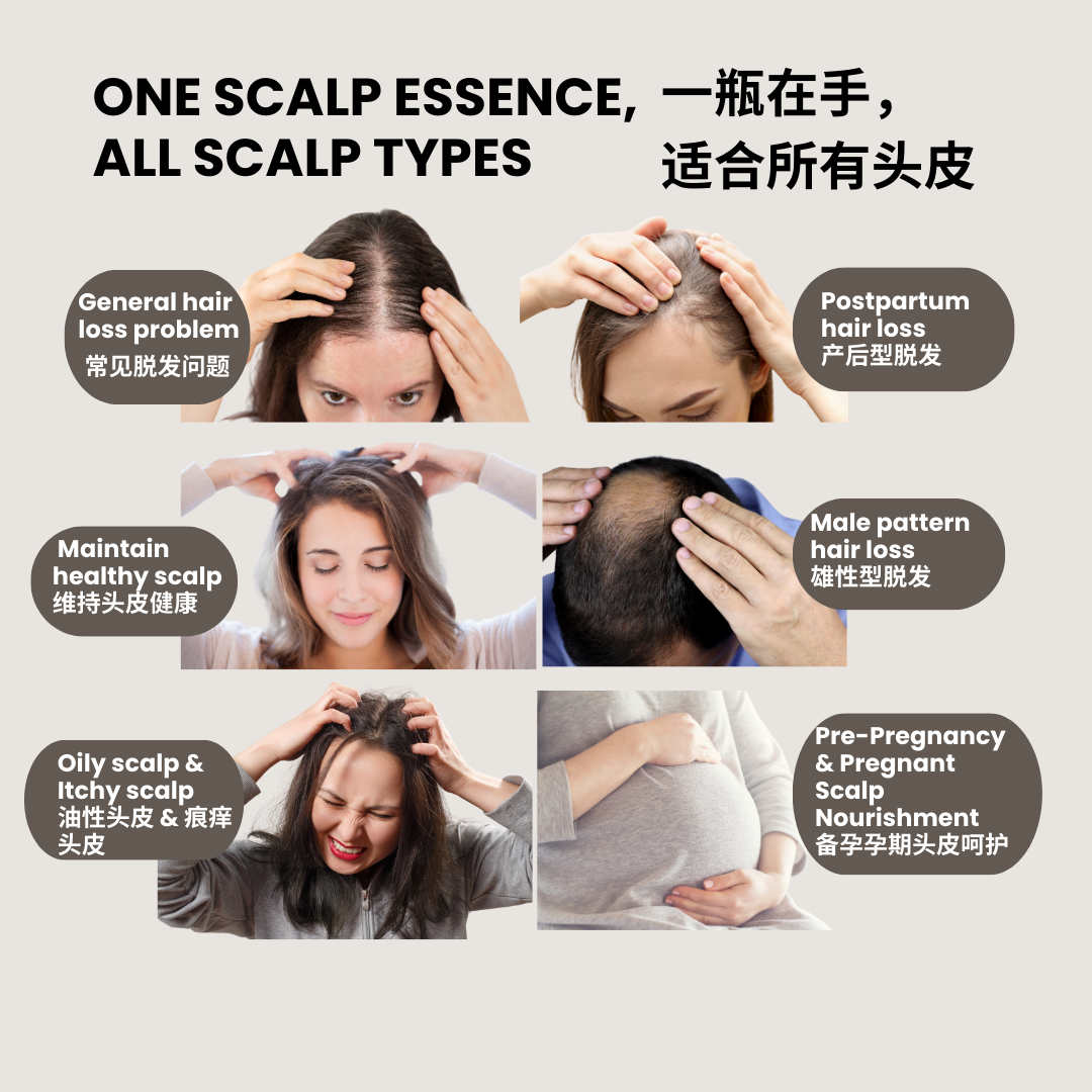 Scalp Revitalizing Essence 100ml